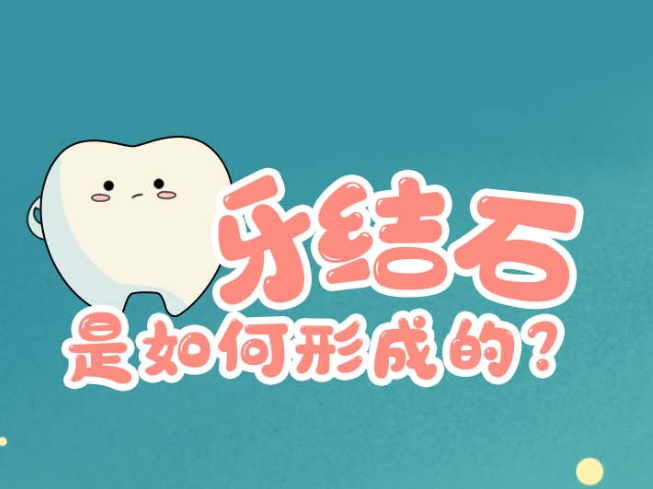 牙齿也能长结石？刷牙能刷掉吗？